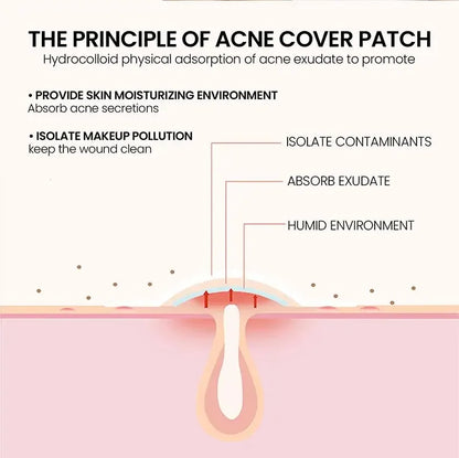 200pcs Repair Acne Patch Facial Skin Care