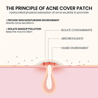 200pcs Repair Acne Patch Facial Skin Care